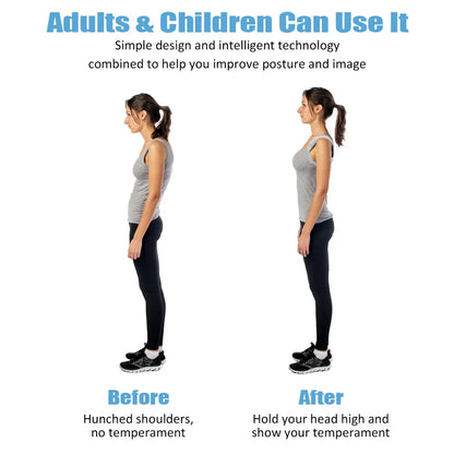 Smart Posture Corrector with Sensor – Vibrating Back & Neck Trainer for Adults & Kids (Invisible Adjustable Brace)